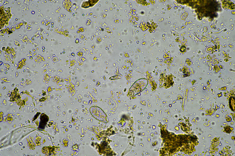 Mkroorganizmy glebowe widziane pod mikroskopem - żywa gleba